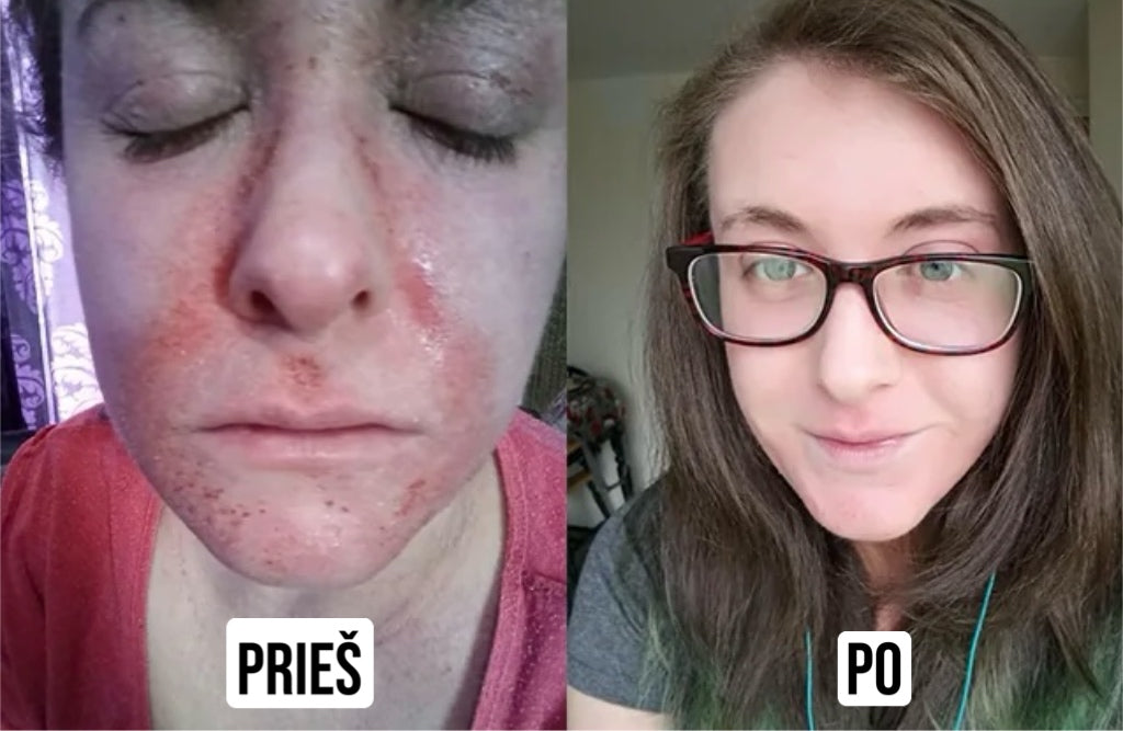 Serumas visoms odos problemoms