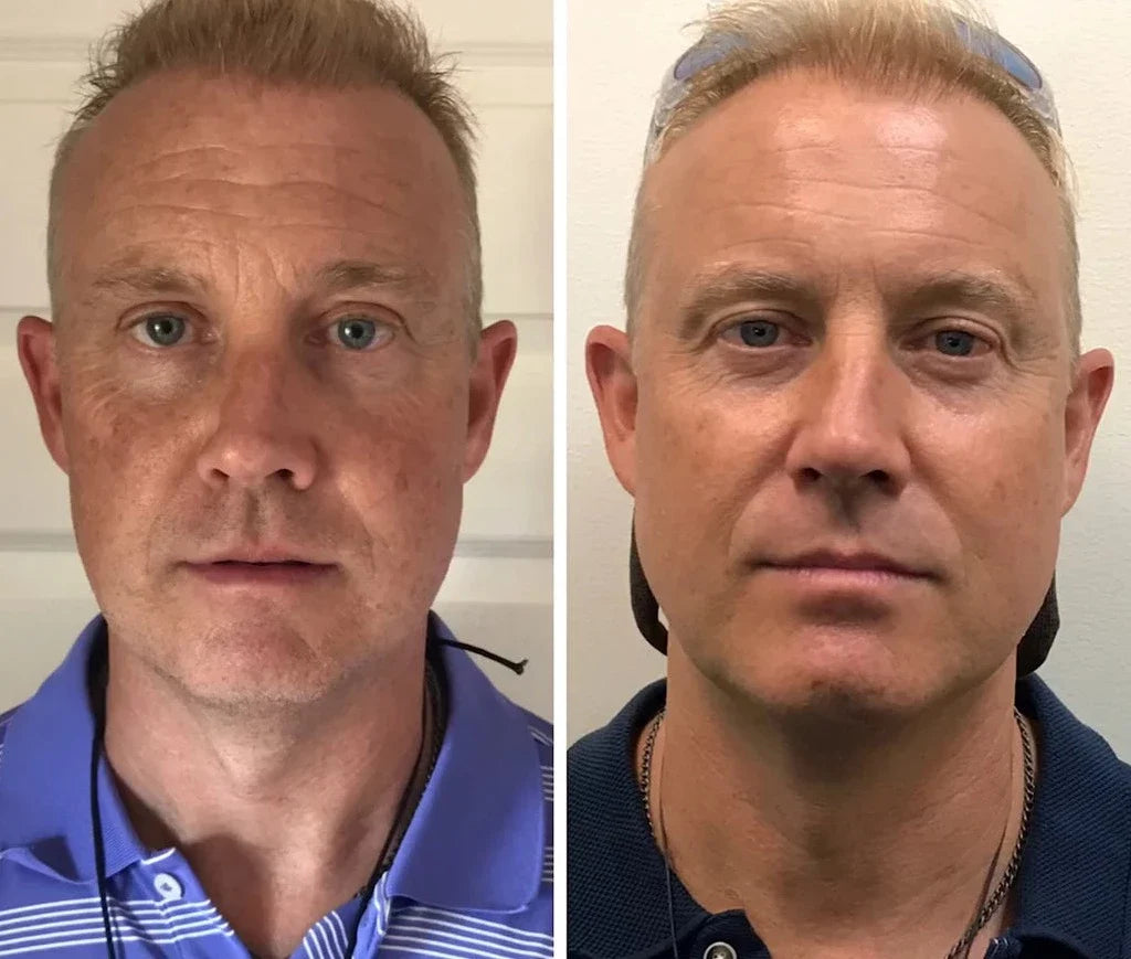 Žandikaulio raumenų lavinimo kamuoliukas (2 vnt.)