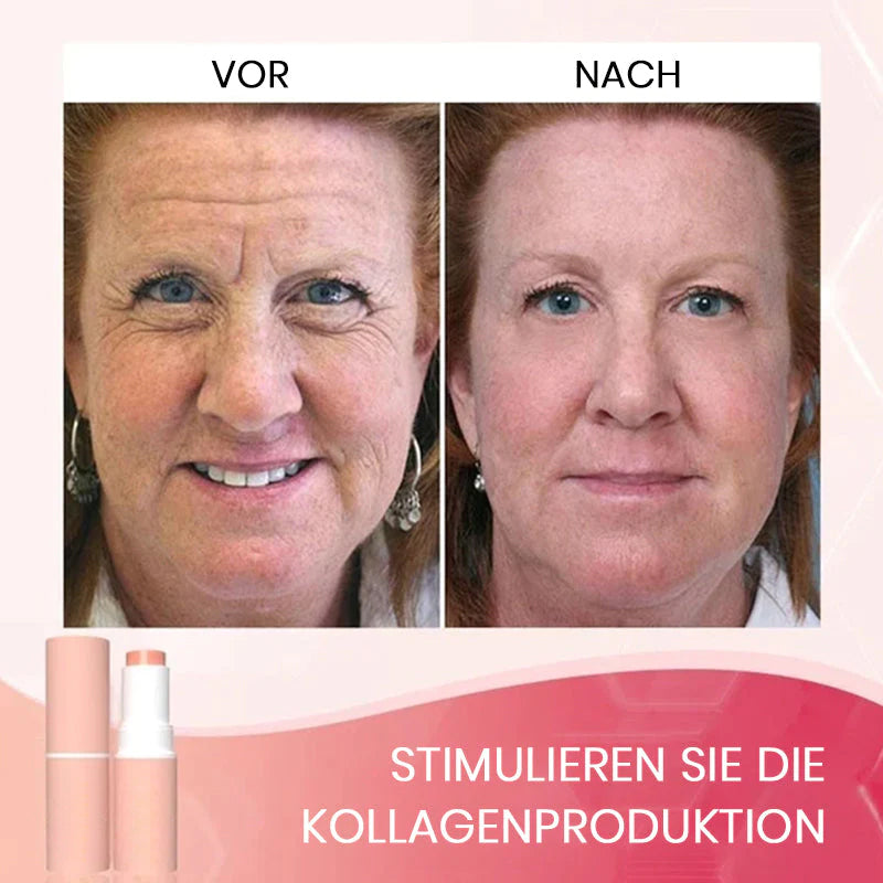 Drėkinamoji veido lazdelė nuo raukšlių