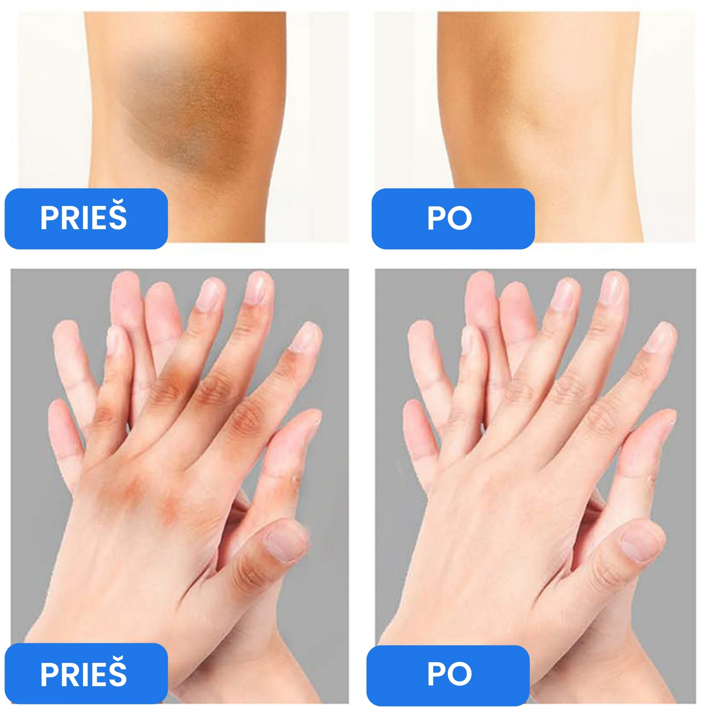 Balinamasis kūno kremas