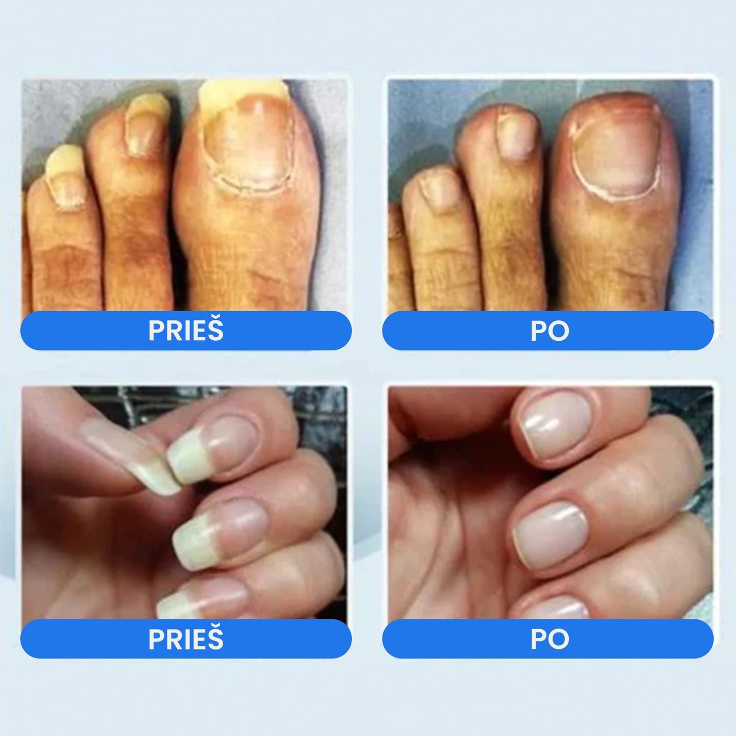 NailCutter™ - profesionalus nagų priežiūros rinkinys