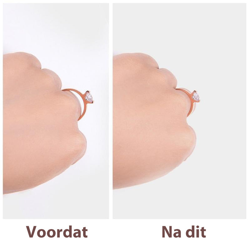 Specialios žiedo dydžio mažinimo juostelės