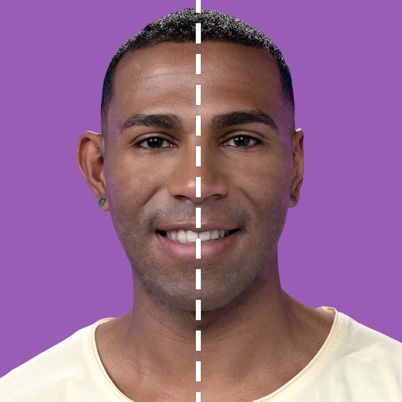 Bespalviai pleistrai atlėpusioms ausims