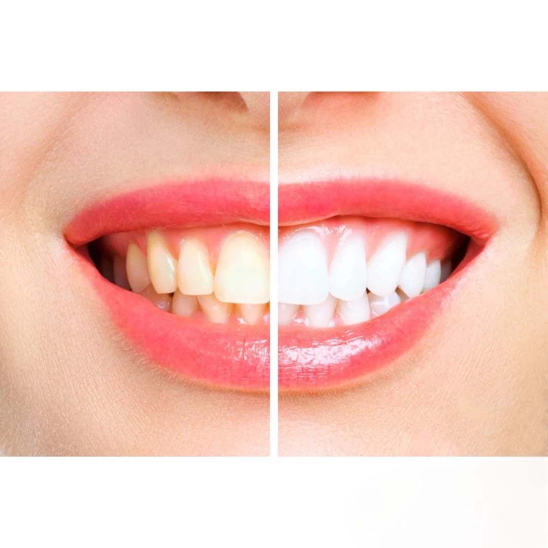 OralTech Pro | Ateities technologijos burnos priežiūrai