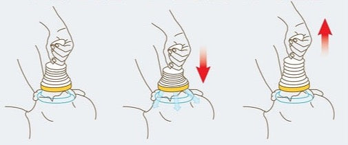 Pirmosios pagalbos kaukė užspringus