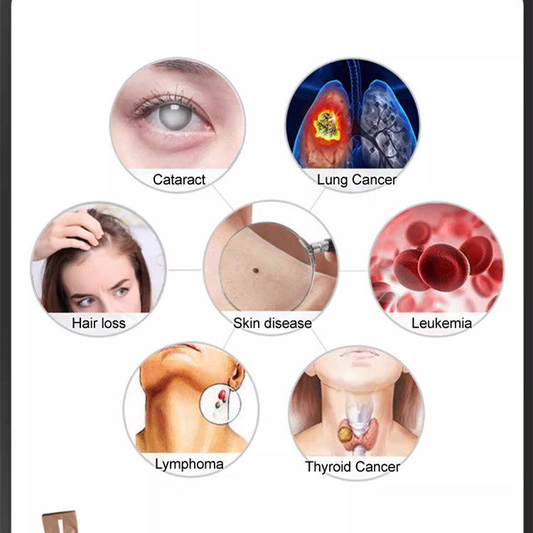 5 mikronų vandens valymo filtras